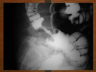 X-Rays.pptx egfhgfegfgefgfigfriegiuergrg