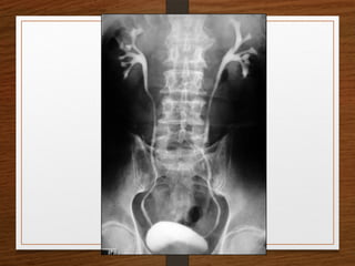 X-Rays.pptx egfhgfegfgefgfigfriegiuergrg