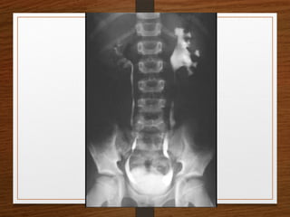 X-Rays.pptx egfhgfegfgefgfigfriegiuergrg