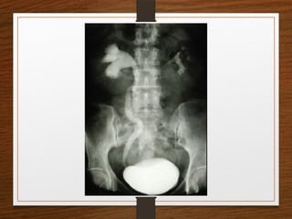 X-Rays.pptx egfhgfegfgefgfigfriegiuergrg