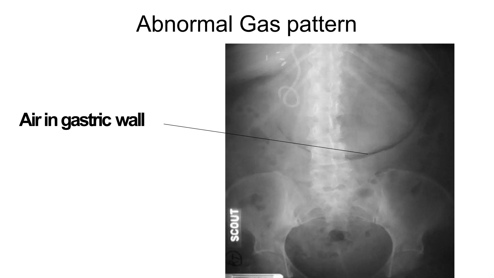 X rays in surgery for undergraduates Dr Dev Taneja-06.06.2021