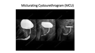 X rays in surgery for undergraduates Dr Dev Taneja-06.06.2021