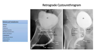 Cystourethrogram Technique X rays in surgery for undergraduates Dr Dev Taneja-06.06.2021