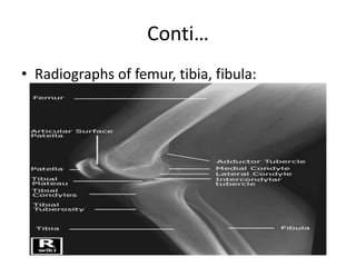 Conti…
• Radiographs of femur, tibia, fibula:
 