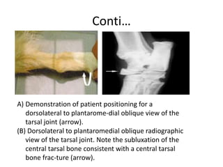 Conti…
A) Demonstration of patient positioning for a
dorsolateral to plantarome-dial oblique view of the
tarsal joint (arrow).
(B) Dorsolateral to plantaromedial oblique radiographic
view of the tarsal joint. Note the subluxation of the
central tarsal bone consistent with a central tarsal
bone frac-ture (arrow).
 