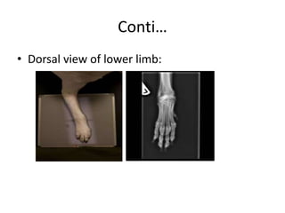 Conti…
• Dorsal view of lower limb:
 