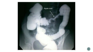 X-rays & Specimen.pptx
