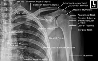 X-Rays with well labelled parts