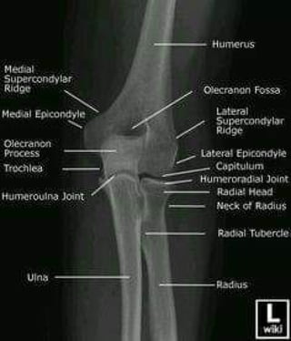 X-Rays with well labelled parts