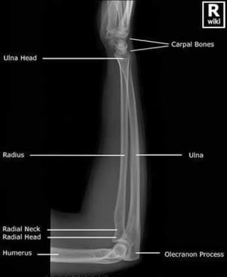 X-Rays with well labelled parts