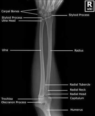 X-Rays with well labelled parts