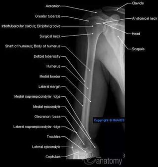 X-Rays with well labelled parts