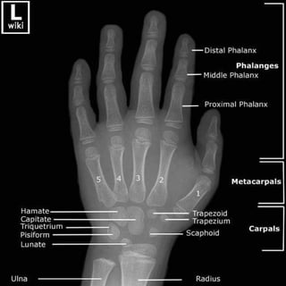 X-Rays with well labelled parts
