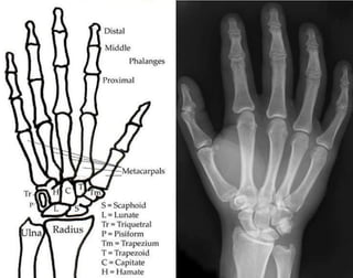 X-Rays with well labelled parts