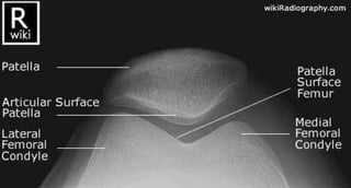 X-Rays with well labelled parts