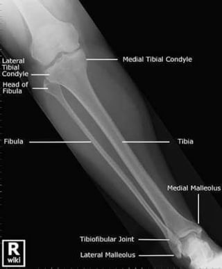 X-Rays with well labelled parts