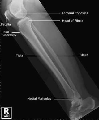 X-Rays with well labelled parts