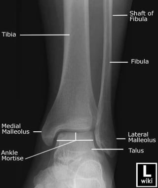 X-Rays with well labelled parts