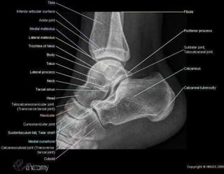 X-Rays with well labelled parts