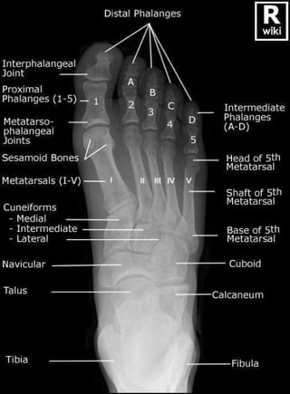 X-Rays with well labelled parts
