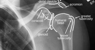 X-Rays with well labelled parts