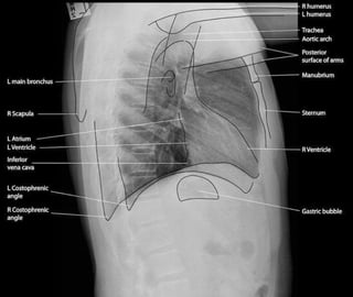 X-Rays with well labelled parts