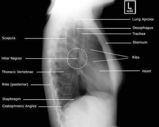 X-Rays with well labelled parts