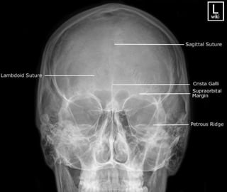 X-Rays with well labelled parts