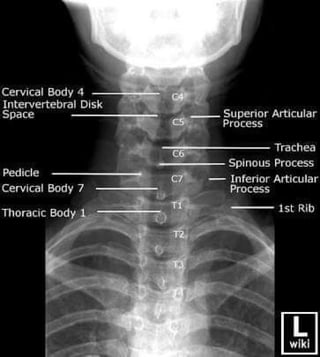 X-Rays with well labelled parts