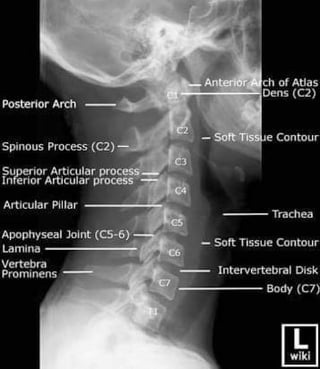 X-Rays with well labelled parts