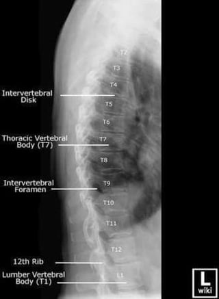 X-Rays with well labelled parts