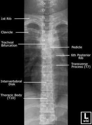 X-Rays with well labelled parts