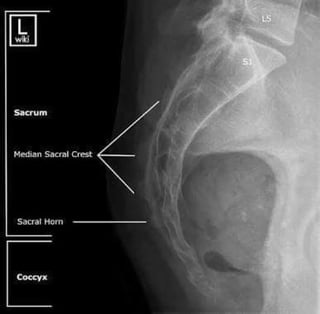 X-Rays with well labelled parts