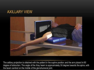 X-Rays with well labelled parts