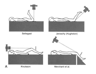 X-Rays with well labelled parts