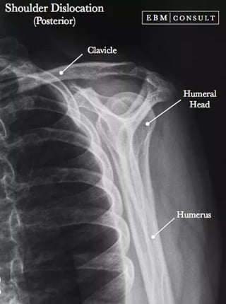 X-Rays with well labelled parts