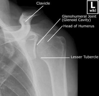 X-Rays with well labelled parts