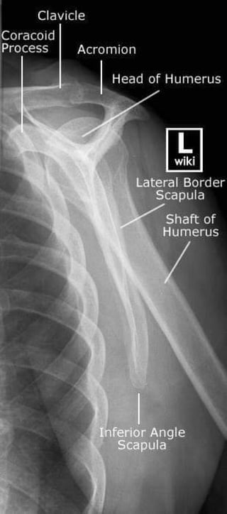 X-Rays with well labelled parts