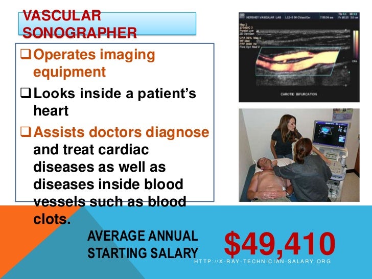 XRay Technician Salary