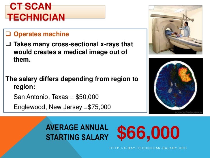 what is the average salary of an x ray technician what is the average salary of an x ray technician