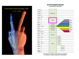 X-rays Discovered by Roentgen, 1895
λ = 0.1 – 10 nm
 