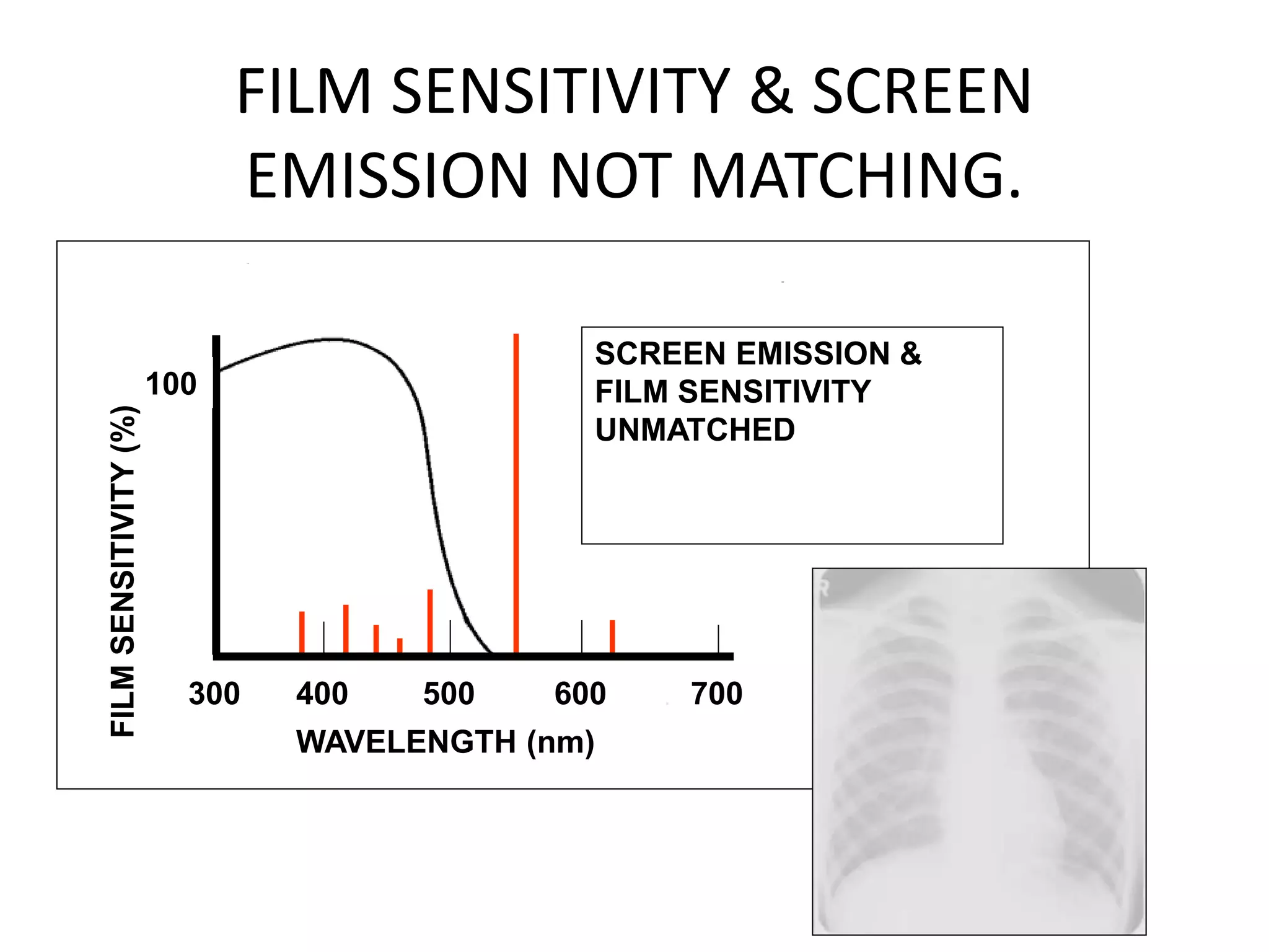 FILM SENSITIVITY & SCREEN
EMISSION NOT MATCHING.
300 500 600 700400
100
WAVELENGTH (nm)
FILMSENSITIVITY(%)
SCREEN EMISSION &
FILM SENSITIVITY
UNMATCHED
 