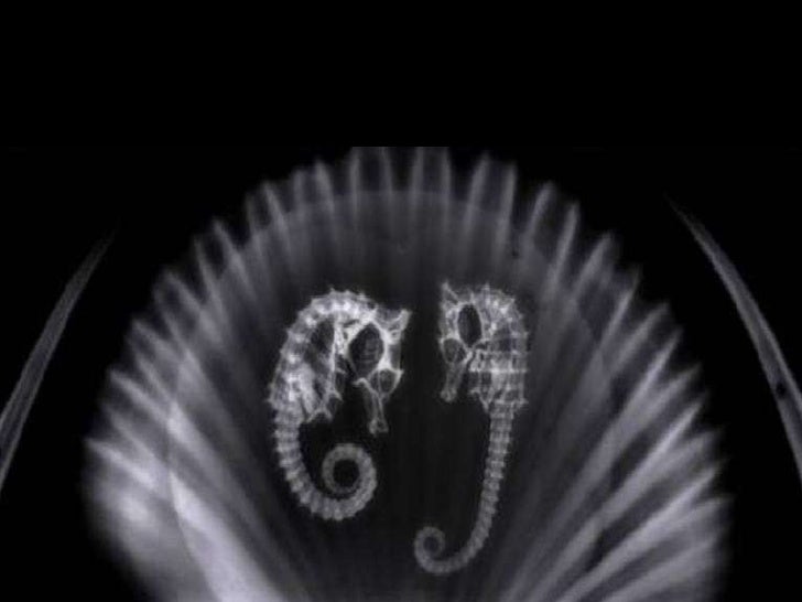 Download X Ray With Love