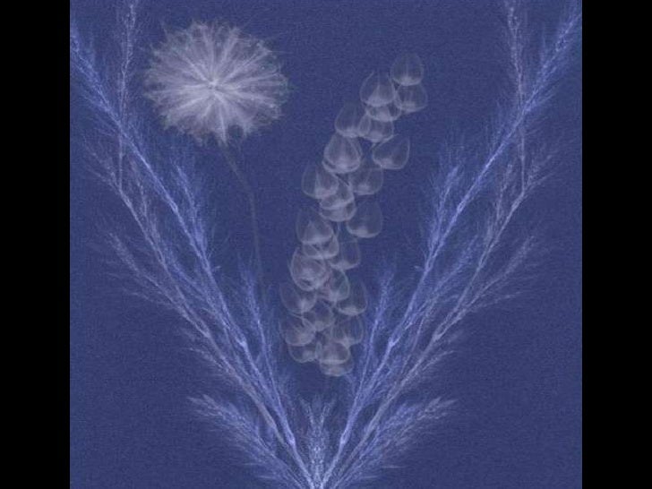 Download X Ray With Love