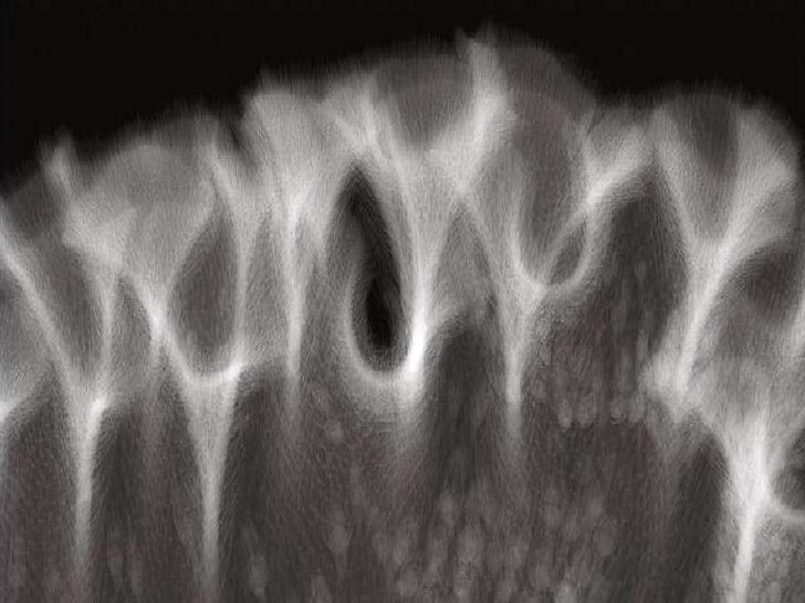 Download X Ray With Love