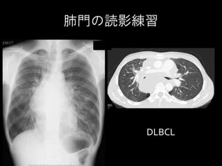 胸部x線写真の診かた 胸部x線写真の診かた