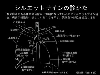 胸部x線写真の診かた 胸部x線写真の診かた