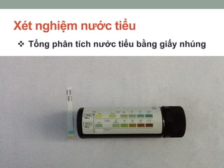 Xét nghiệm nước tiểu
 Tổng phân tích nước tiểu bằng giấy nhúng
 