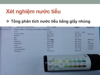 Xét nghiệm nước tiểu
 Tổng phân tích nước tiểu bằng giấy nhúng
 