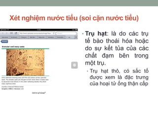 Xét nghiệm nước tiểu (soi cặn nước tiểu)
• Trụ hạt: là do các trụ
tế bào thoái hóa hoặc
do sự kết tủa của các
chất đạm bên trong
một trụ.
• Trụ hạt thô, có sắc tố
được xem là đặc trưng
của hoại tử ống thận cấp
 